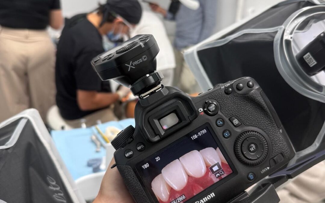 Tratamientos dentales mínimamente invasivos: qué son y por qué están revolucionando la odontología estética