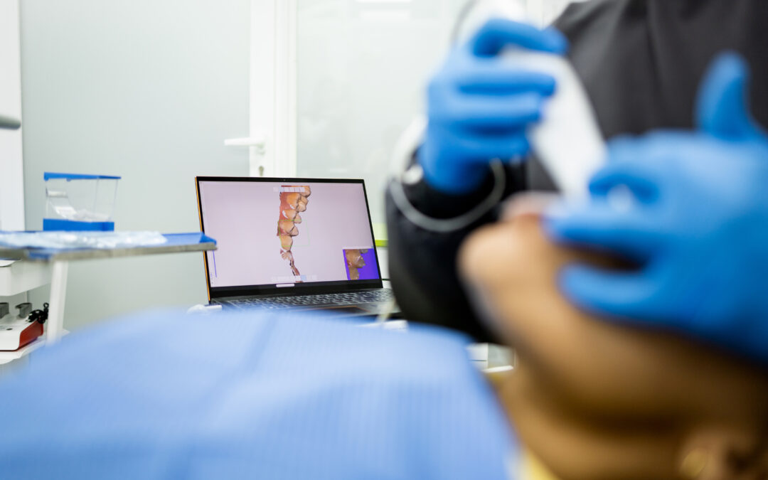 Por qué un diagnóstico personalizado y tecnológico asegura el éxito en tu diseño de sonrisa con carillas