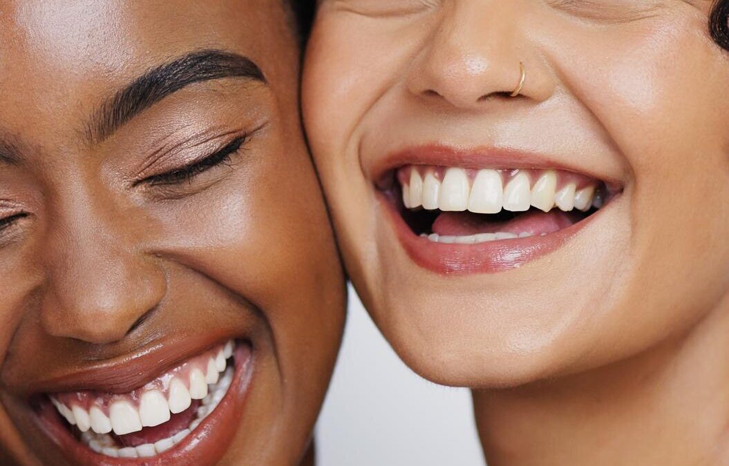 Guía para saber si las carillas son la opción adecuada para tu sonrisa